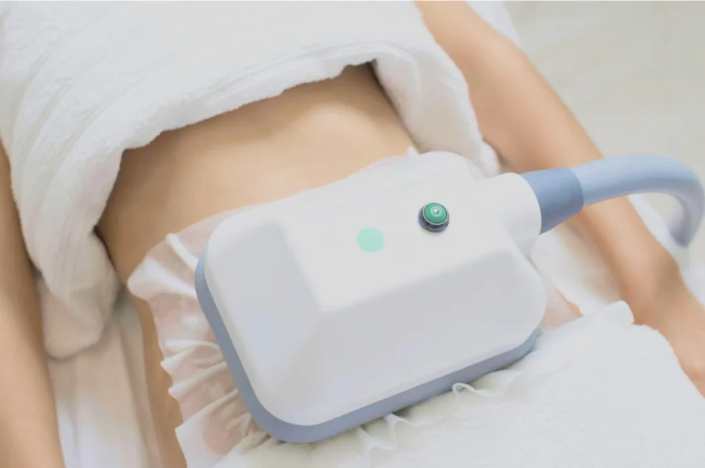 How Fat Freezing and HIFU Work Together? 3 advantages to combining Fat Freezing and HIFU Port Glasgow