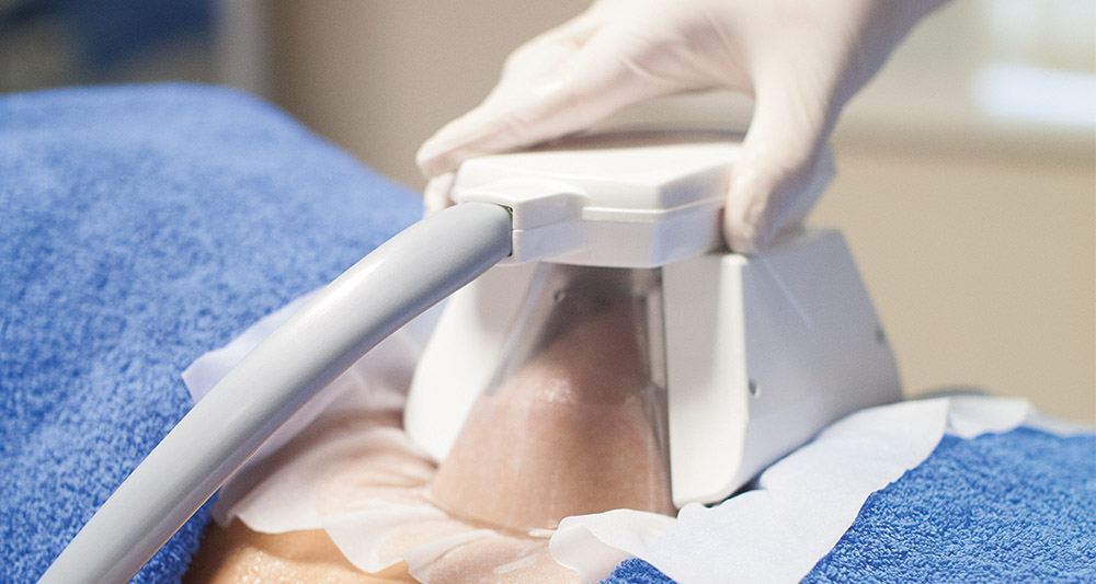 How Fat Freezing and HIFU Work Together? 2 Multiple Areas in One Session HIFU and Fat Freezing Port Glasgow