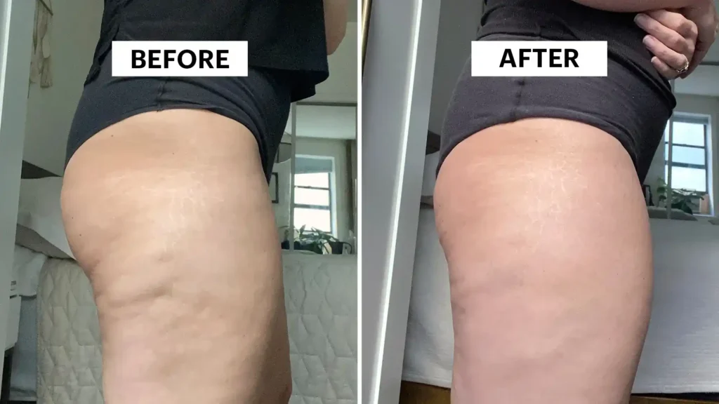 Sculpting Your Bum: Can Toning Exercises Really Reduce Cellulite? 1 Do Toning Exercise Port Glasgow Really Tackle Cellulite?